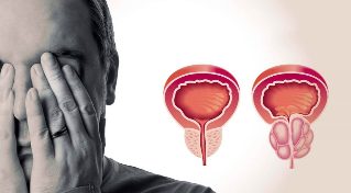 Prostate saine et enflammée