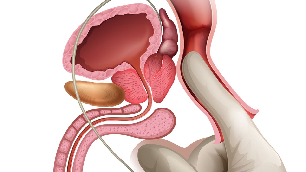 Le massage de la prostate est un moyen efficace de traiter la prostatite congestive